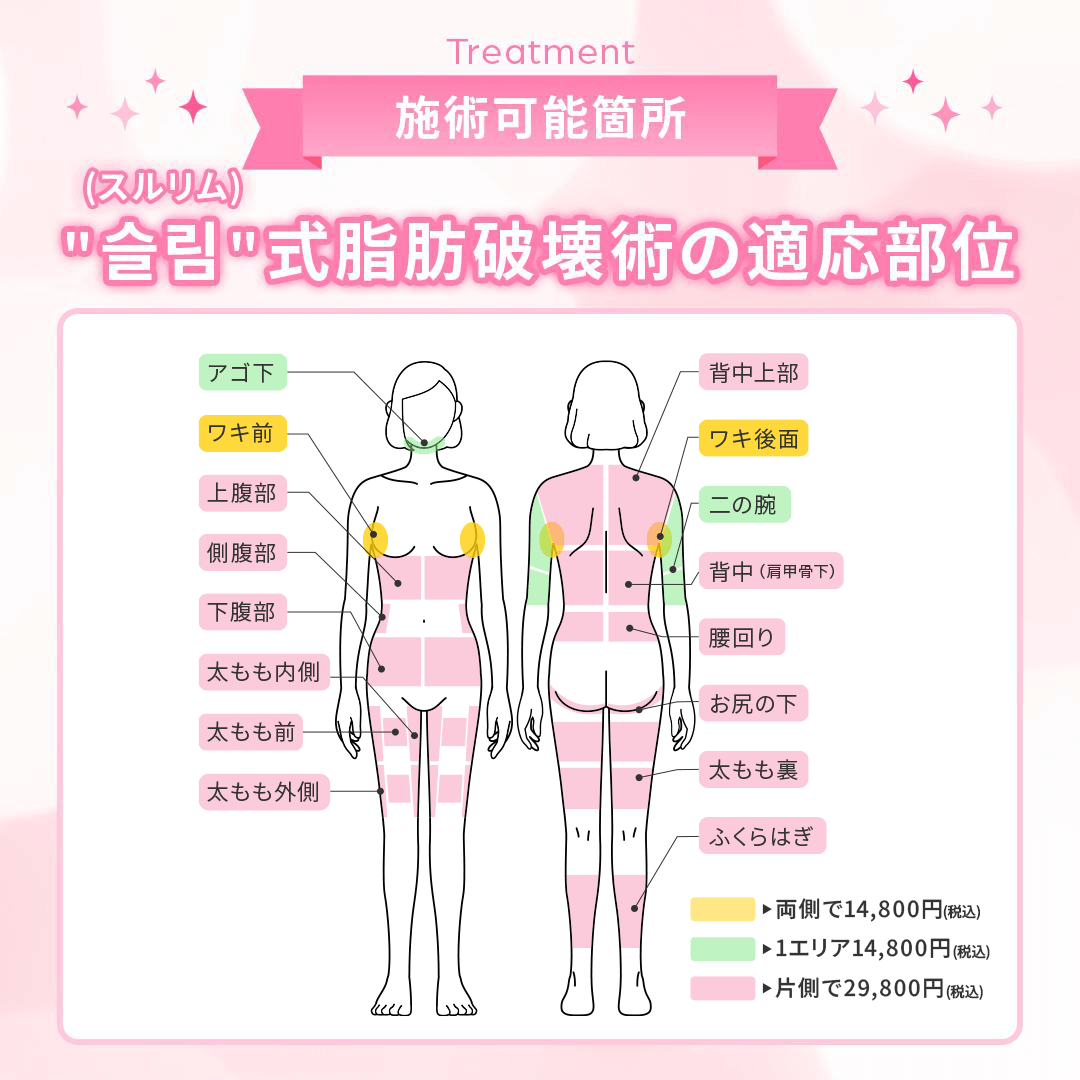 スルリム式脂肪破壊術の適応部位