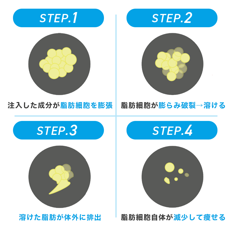 スルリム式脂肪破壊術の仕組み