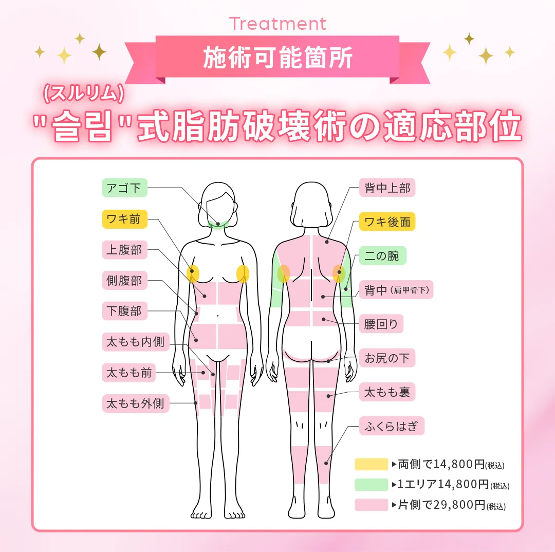 スルリム式脂肪破壊術の適応部位