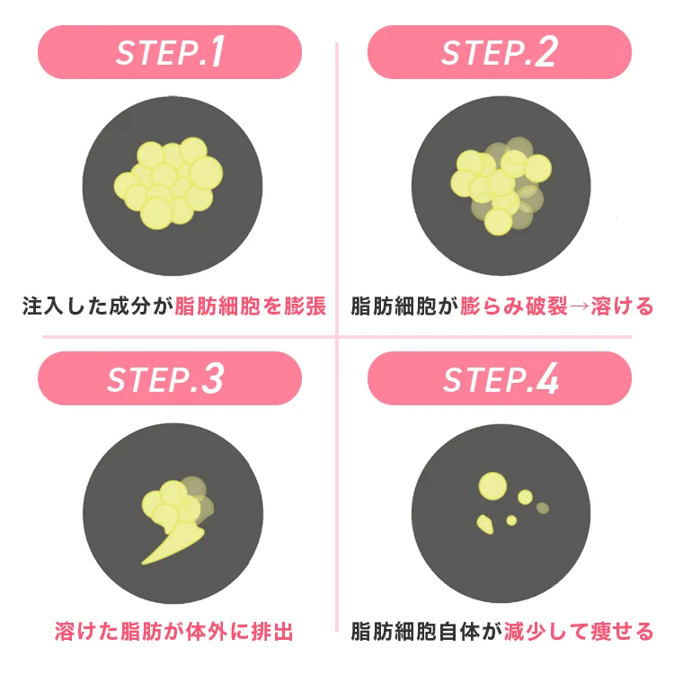 スルリム式脂肪破壊術の仕組み